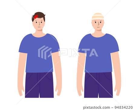 Human head trauma Human head trauma 94834220
