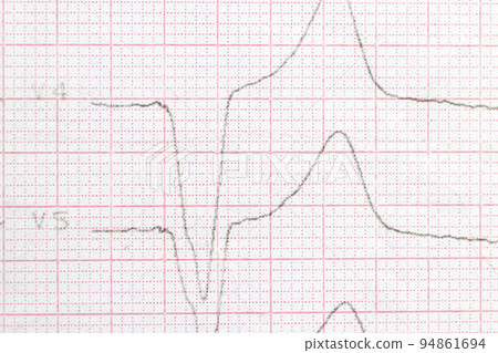 Macro photo of ECG cardiogram of a patient with a heart attack. Macro photo of ECG cardiogram of a patient with a heart attack. 94861694
