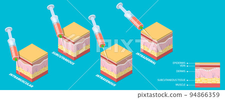 3D Isometric Flat Vector Conceptual Illustration of Injection Types 94866359