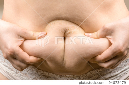 woman hand holding excessive belly fat, overweight concept. woman with fat belly, overweight female body, close-up studio shot. concept of dieting, losing weight 94872479