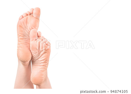 Female legs, feet with dry skin on heels and soles needs care in spa beauty salon. rough skin on female feet isolated on white background Female legs, feet with dry skin on heels and soles needs care in spa beauty salon. rough skin on female feet isolated on white background 94874105