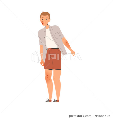 Man Character Suffering from Neurodermatitis Having Itchy Skin Covered with Red Spots Vector Illustration Man Character Suffering from Neurodermatitis Having Itchy Skin Covered with Red Spots Vector Illustration 94884326