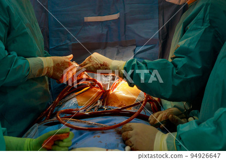 During open heart surgery, if the heart valve malfunctions, a valve replacement is performed in the operating room to resolve this issue 94926647
