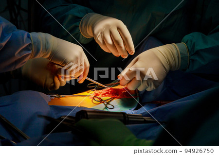 A doctor sews up a leg after an injury that occurred in the operating room 94926750