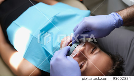 Woman with dental cast veneer on upper jaw in dentistry Woman with dental cast veneer on upper jaw in dentistry 95002824