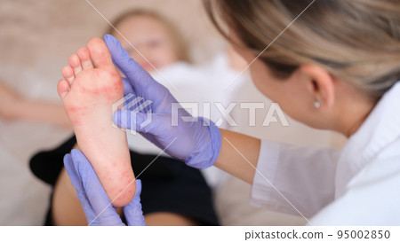 Doctor conducts medical examination of leg of child with red itchy rash closeup 95002850