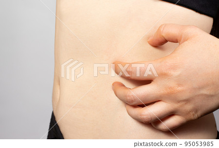 The woman scratches the skin of the side of the abdomen, scabies. Contagious skin disease, dermatitis and skin itching. Allergic urticaria The woman scratches the skin of the side of the abdomen, scabies. Contagious skin disease, dermatitis and skin itching. Allergic urticaria 95053985