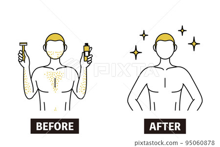 The image of unwanted hair removal, the image of a man suffering from thick body hair shaving his hair or treating it with a depilatory cream to become full of confidence. The image of unwanted hair removal, the image of a man suffering from thick body hair shaving his hair or treating it with a depilatory cream to become full of confidence. 95060878