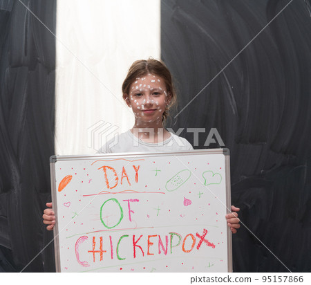 A little schoolgirl with chickenpox draws a message on the whiteboard in the kids' room, and antiseptic cream is applied to the face and body. Chalkboard background.  95157866