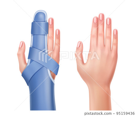 Hand with brace Hand with brace 95159436