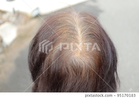 Thin hair female white hair Japanese 95170183