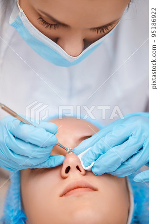 woman during a mechanical face cleansing procedure woman during a mechanical face cleansing procedure 95186922