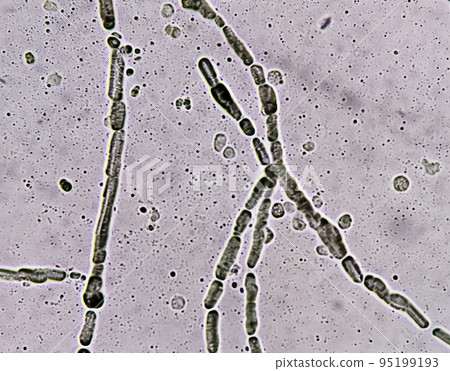 Microscopic image showing Hyphae of dermatophytes, skin scraping for fungus test Microscopic image showing Hyphae of dermatophytes, skin scraping for fungus test 95199193