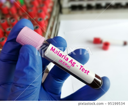 Researcher holding blood sample for malaria antigen test. 95199534