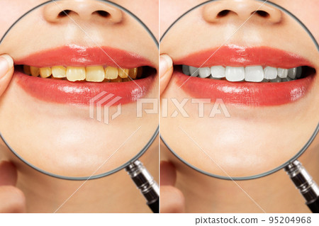 Whitening 95204968
