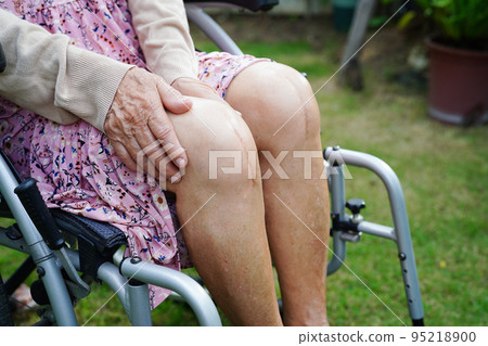 Asian elderly woman patient with scar knee replacement surgery in hospital. Asian elderly woman patient with scar knee replacement surgery in hospital. 95218900