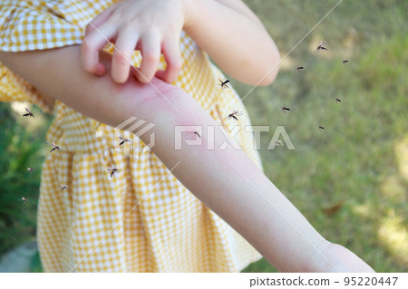 Little girl has skin rash allergy and itchy on her arm from mosquito bite 95220447