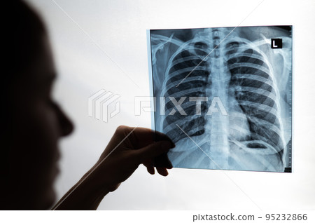 Doctor showing x-ray of patient's lungs.  95232866