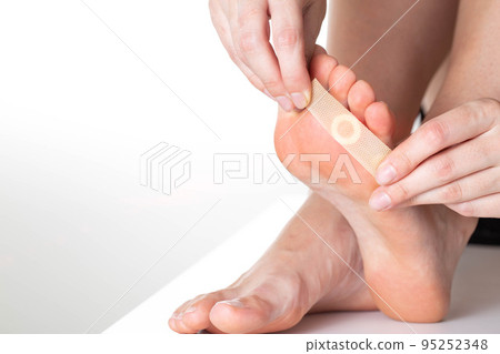 A girl sticks a medical plaster for plantar warts on her leg. Callus treatment. Copy space for text A girl sticks a medical plaster for plantar warts on her leg. Callus treatment. Copy space for text 95252348