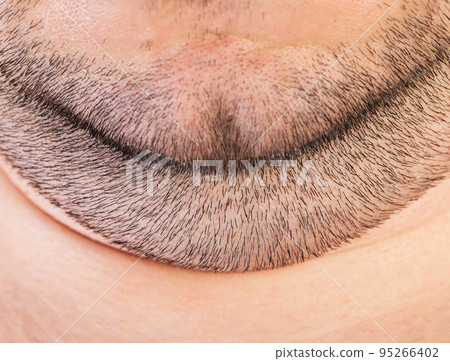 Thick double chin with stubble on the face. Aesthetic defect, chin correction exercises. Macro Thick double chin with stubble on the face. Aesthetic defect, chin correction exercises. Macro 95266402
