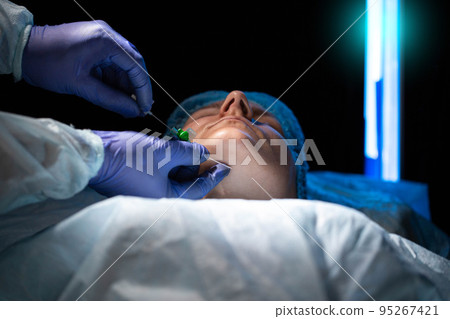 A doctor plastic surgeon removes a double chin from a female patient with the help of self-absorbing mesothreads. Modern plastic surgery, facelift. Close-up 95267421