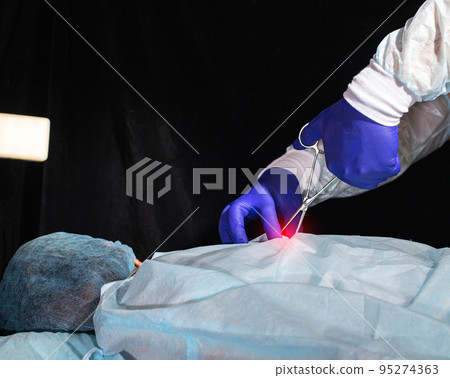 A spinal surgeon performs a hernia surgery on a patient's back. Myelopathy, copy space for text. Vertebroplasty 95274363