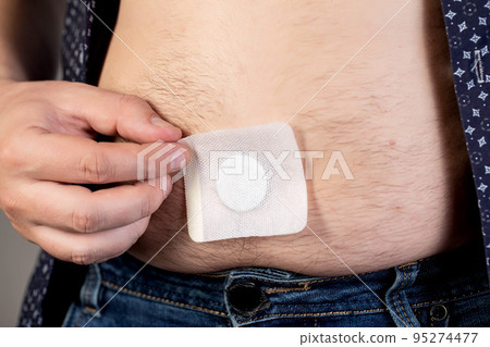 A modern medical patch for prostatitis and urinary tract infections. A man glues a urological patch on his stomach, close-up 95274477