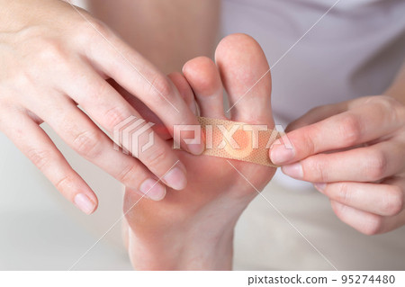 Woman sticks a medical plaster to the plantar wart of the leg to remove dead skin and calluses, close-up 95274480
