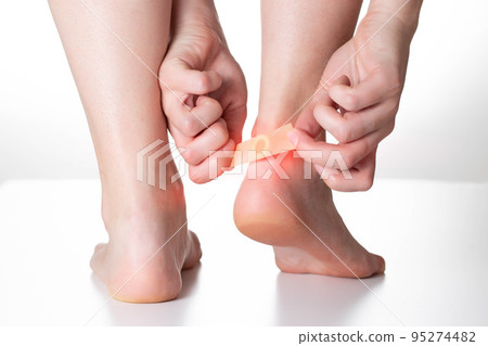 A woman sticks a medical plaster for the treatment of warts on the foot. Close-up 95274482