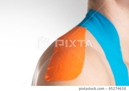 Fixation of muscles and ligaments on the girl's shoulder with blue and orange kinesiological tape, close-up. Taping in sports 95274638