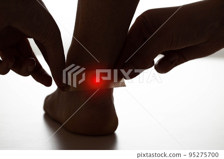 A girl sticks a medical plaster on her heel to treat calluses on her feet. Callus pain A girl sticks a medical plaster on her heel to treat calluses on her feet. Callus pain 95275700