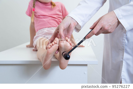 A doctor, a neurologist, checks the babinsky reflex on the sole of the foot. Neurological hammer. Children's neuralgia 95276227