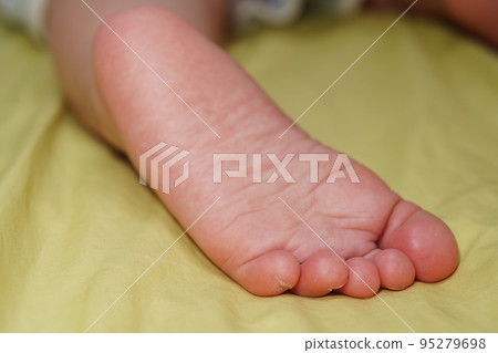 barefoot 95279698