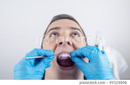 Installation of braces, bridges and a dental plate to correct teeth. An orthodontist installs a bracket system on an uneven jaw. Implants and smile correction. Concept of working in the dentist office Installation of braces, bridges and a dental plate to correct teeth. An orthodontist installs a bracket system on an uneven jaw. Implants and smile correction. Concept of working in the dentist office 95328006