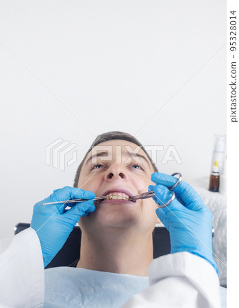 Installation of braces, bridges and a dental plate to correct teeth. An orthodontist installs a bracket system on an uneven jaw. Implants and smile correction. Concept of working in the dentist office Installation of braces, bridges and a dental plate to correct teeth. An orthodontist installs a bracket system on an uneven jaw. Implants and smile correction. Concept of working in the dentist office 95328014