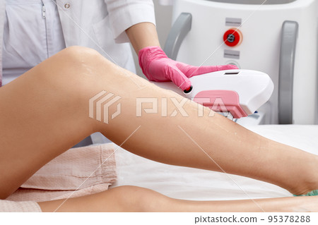 Laser depilation or photoepilator process on a woman leg. 95378288