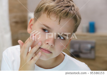 The teenager looks at the skin of his face in annoyance. The teenager looks at the skin of his face in annoyance. 95386153