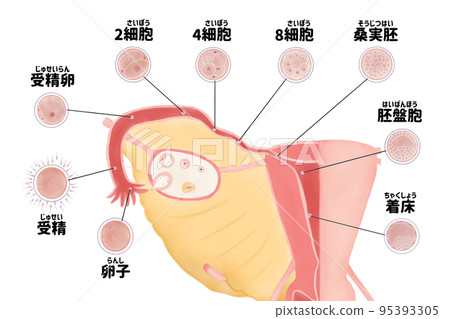 Illustration from human fertilization to implantation Japanese Illustration from human fertilization to implantation Japanese 95393305