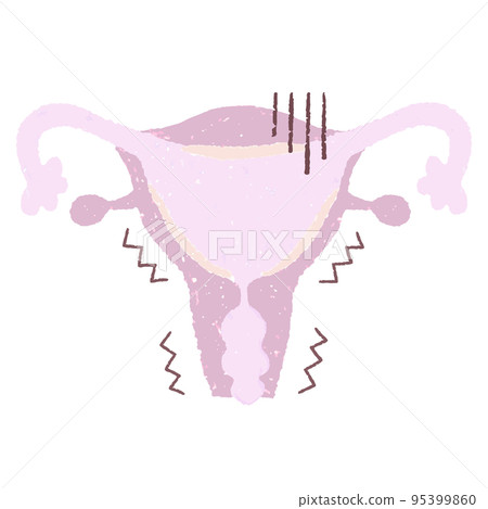 手繪不健康的子宮 95399860