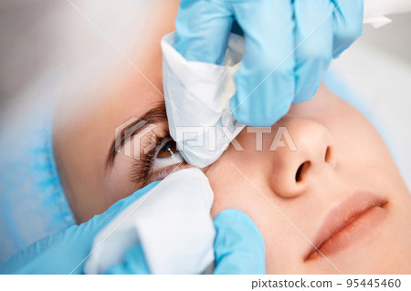 beautician removes lipoma on young female face beautician removes lipoma on young female face 95445460