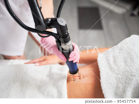 Close-up view of skin abdomen immediately after treatment with carbon dioxide laser. Laser device gradually moving on skin of abdomen, providing maximum area for treatment defected area of skin. 95457754