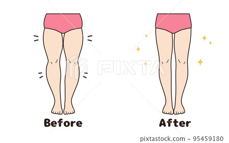 Leg before and after set Leg before and after set 95459180