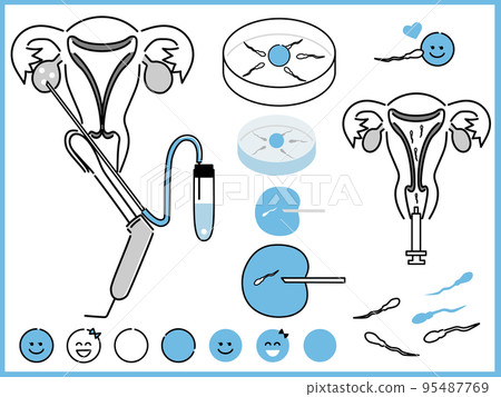 生育治療、顯微授精、體外受精、人工授精的插圖 95487769