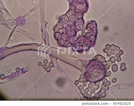 Where the tempeh spores are released Where the tempeh spores are released 95492820