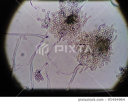 Aspergillus with large sporangia Aspergillus with large sporangia 95494964