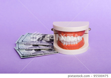 Closeup model of a human jaw with white teeth and dollar bill. Dentistry conceptual photo. Prosthetic dentistry. False teet top view with copy space 95500475