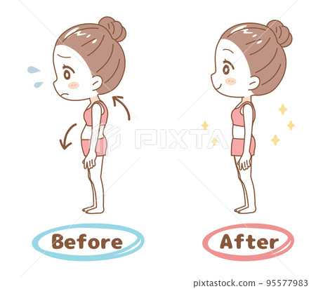 Female posture correction before and after set 95577983
