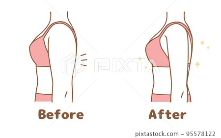 Upper arm before and after set 95578122