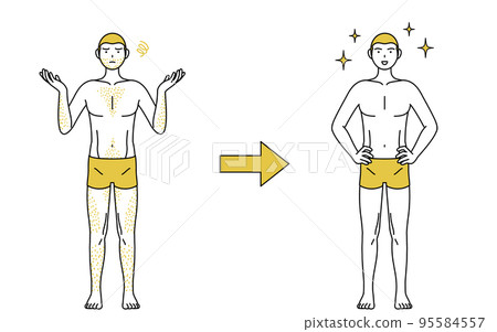 Image of medical hair removal, before and after a man who is worried about having thick body hair loses his hair and becomes full of confidence 95584557