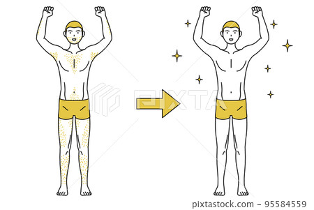Image of medical hair removal, before and after a man who is worried about having thick body hair loses hair and becomes smooth 95584559